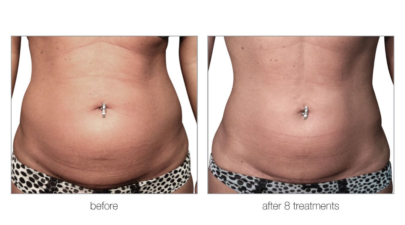 venus legacy before and after11