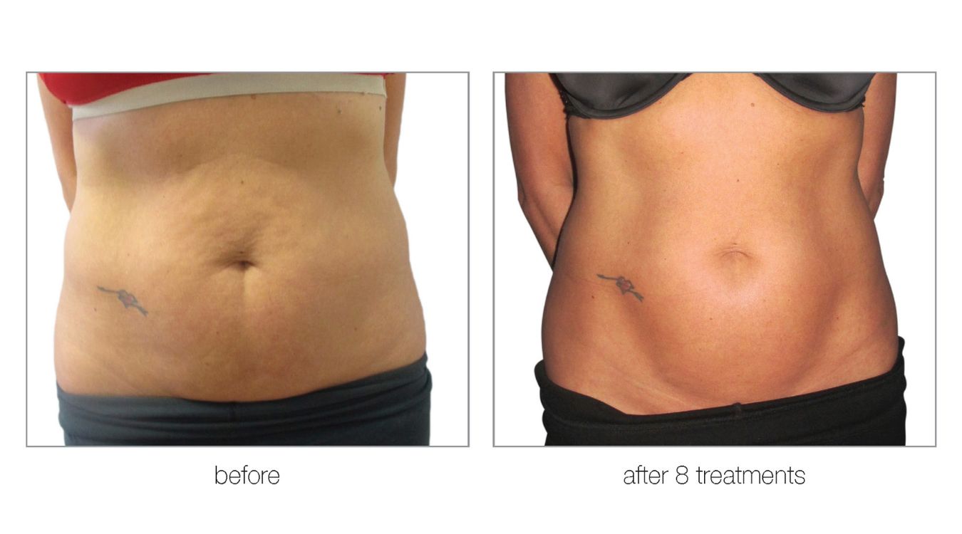 venus legacy before and after4